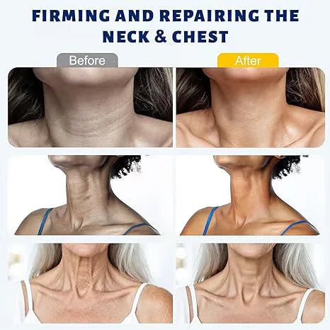 Firm and Smooth the Look ofYour Neck.Reveal Younger-LookingSkin. - Image 3