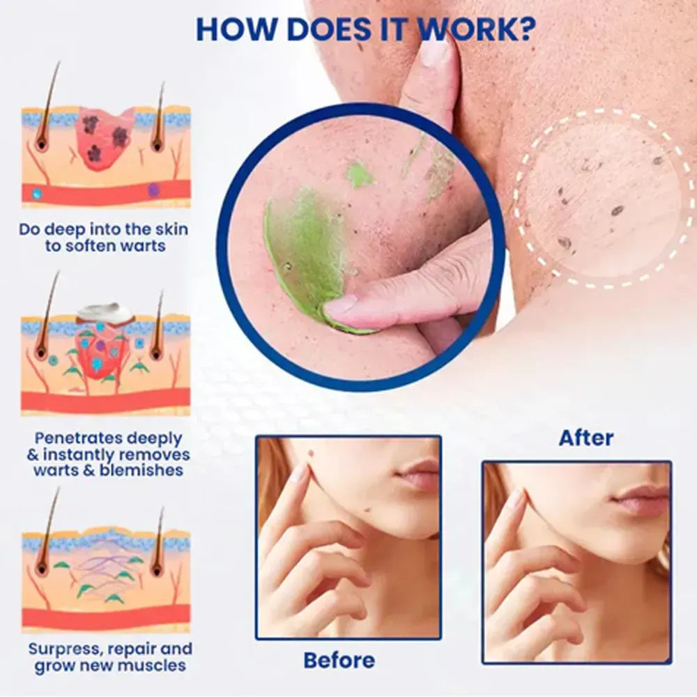 Remove excess marks within 7 days, no surgery, no discomfort, and no $500 clinic fee. - Image 4