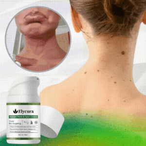 Remove excess marks within 7 days, no surgery, no discomfort, and no $500 clinic fee.
