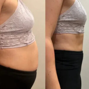 14-Day Colon Detox - Cleanse your colon, transform your energy