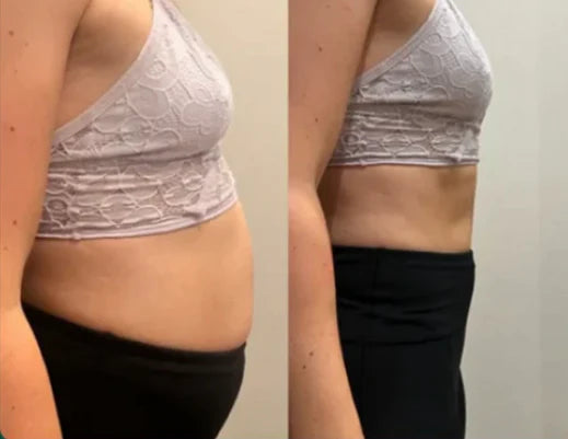 14-Day Colon Detox - Cleanse your colon, transform your energy