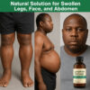 Lymphatic Drainage – Refined Face, Lighter Legs, Flat Stomach