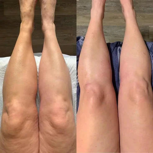 Lymphatic Drainage – Refined Face, Lighter Legs, Flat Stomach
