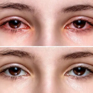 15-in-1 Eye Health Capsules with Lutein