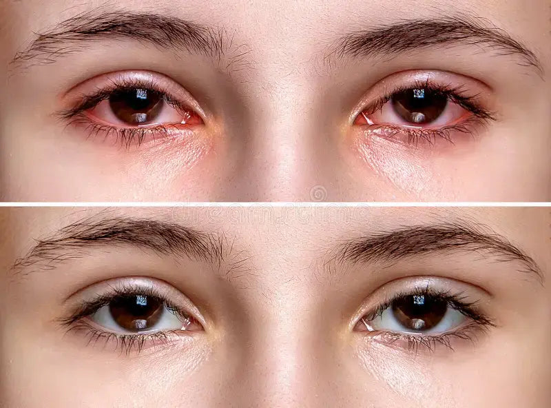 15-in-1 Eye Health Capsules with Lutein