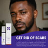 BioCorneum – Scar Treatment with SPF 30