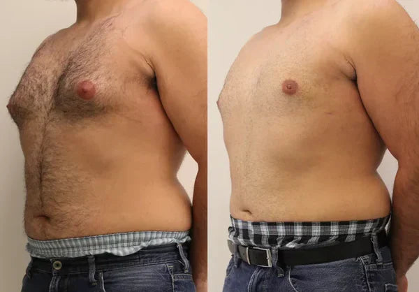 Turkesterone testosterone capsules Tongkat Ali