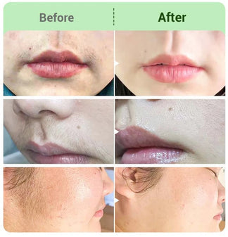 | Painless Hair Removal Cream for Hormonal Facial Hair Dermatologist-Recommended | Smooth, Flawless Skin Without Irritation | Quick & Long- Lasting Results❤❤❤❤ - Image 4