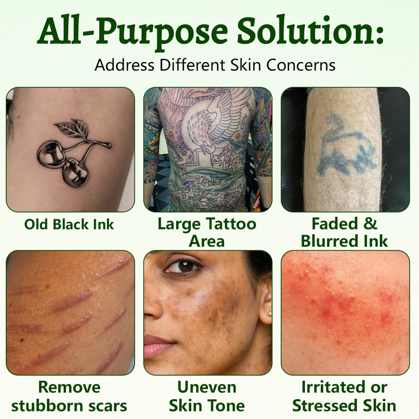 Ceoerty PureAlgae InkRemoval Support SprayB -Say Goodbye to oldTattoo PigmentM,FadeStubborn Ink $, Repair &Smooth Treated Skin-Non-Laser, Try It Now! - Image 2