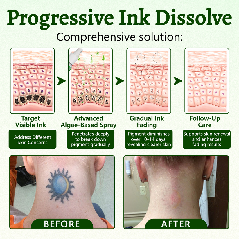 Ceoerty PureAlgae InkRemoval Support SprayB -Say Goodbye to oldTattoo PigmentM,FadeStubborn Ink $, Repair &Smooth Treated Skin-Non-Laser, Try It Now! - Image 3