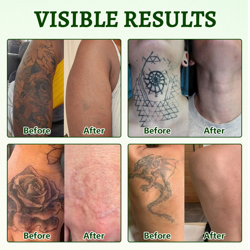 Ceoerty PureAlgae InkRemoval Support SprayB -Say Goodbye to oldTattoo PigmentM,FadeStubborn Ink $, Repair &Smooth Treated Skin-Non-Laser, Try It Now! - Image 6